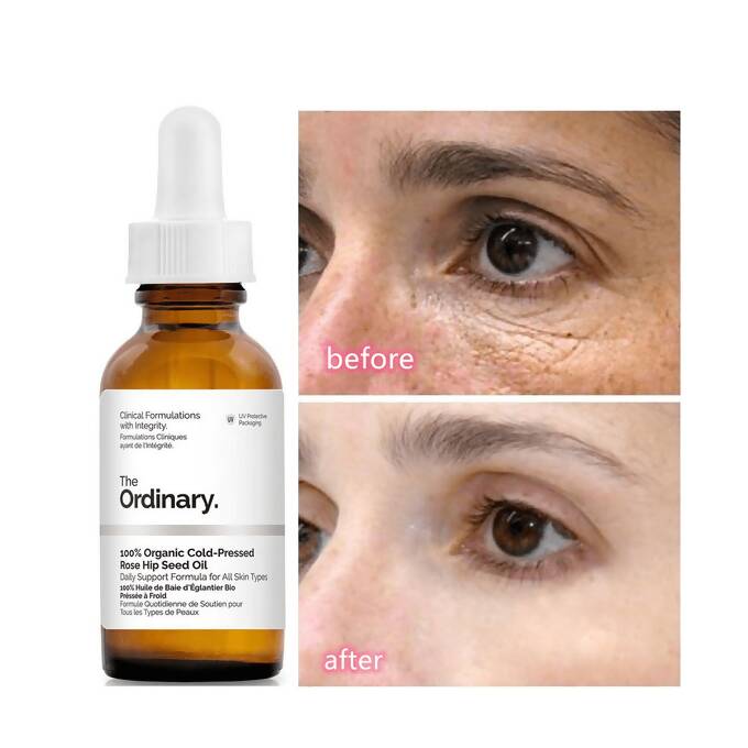 The Ordinary Caffeine Solution 5% + EGCG: Miracle for tired eyes