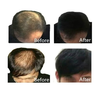 HB HAIR FIBER